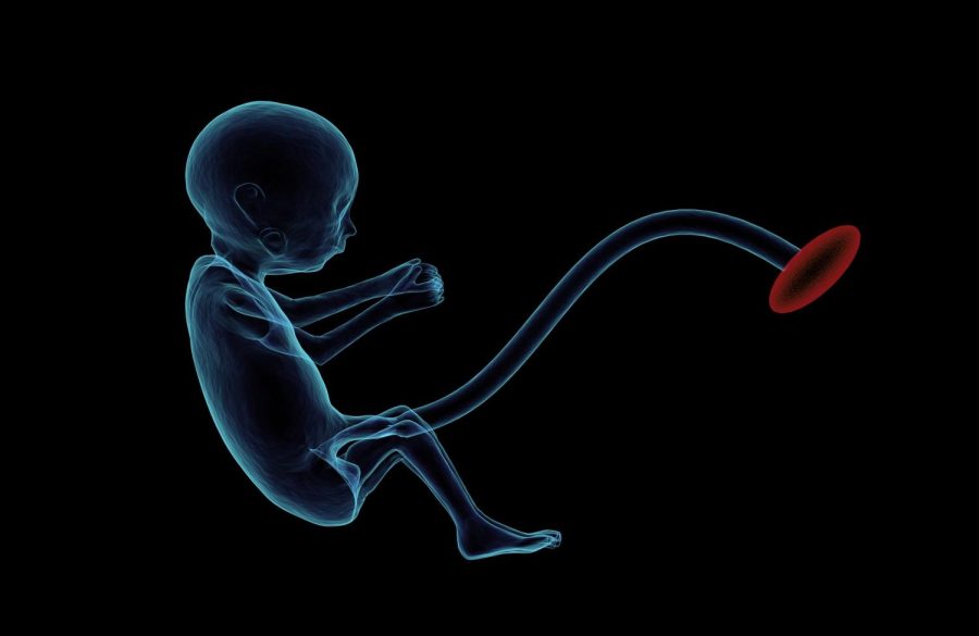 Roe v. Wade set a precedent of only limiting abortion past the point where the fetus is viable outside of the womb.